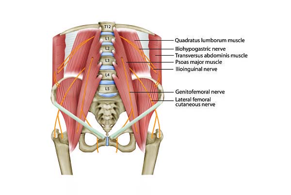 Iliohypogastric Neuralgia