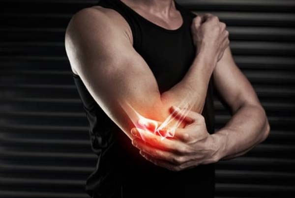 Cubital Tunnel Syndrome