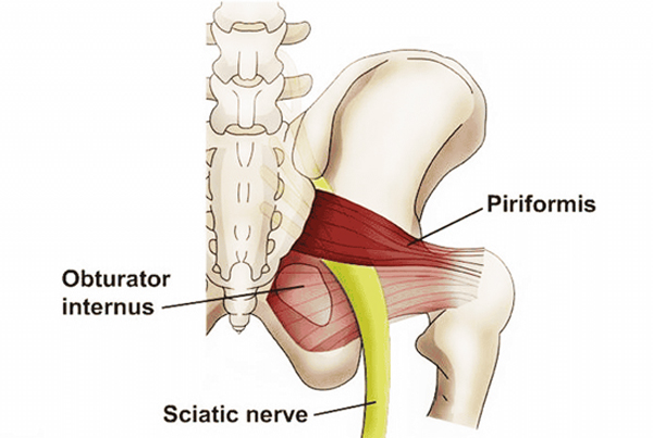 Sciatic Nerve And Piriformis Syndrome